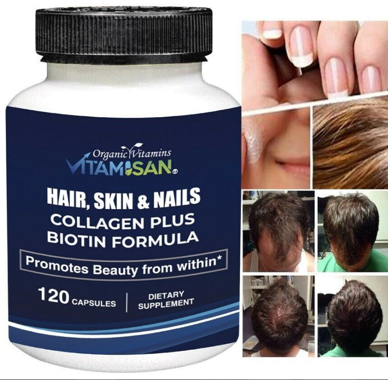 Verbessern Sie die Gesundheit Ihrer Haare, Haut und Nägel mit unserem Vitaminkomplex. Mit 120 Kapseln bietet unser Produkt ausreichend Nährstoffe für ein gesundes und strahlendes Erscheinungsbild. 100% natürlich und wirksam - perfekt für ein verbessertes Wohlbefinden und Selbstvertrauen.